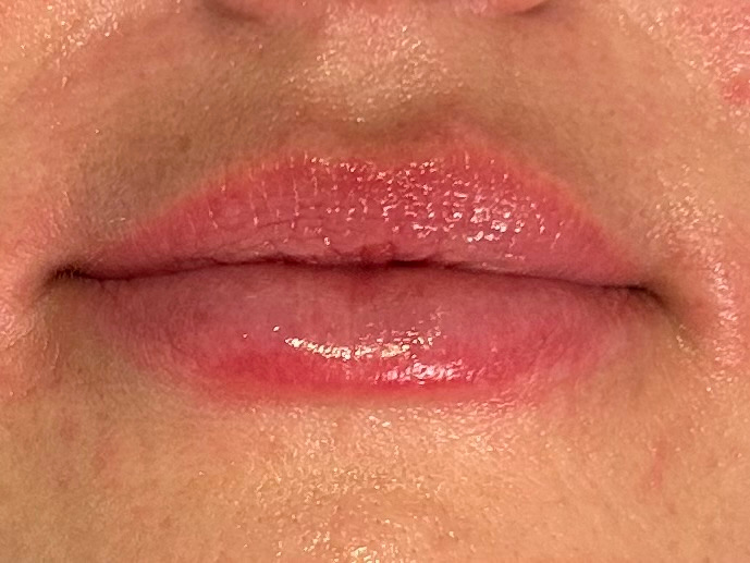 después labios